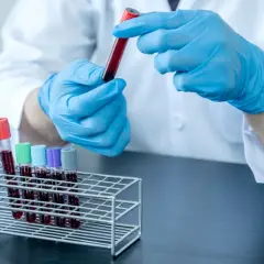 Test z kursu krwiodawstwa: Jak go zdać? Kluczowe zagadnienia