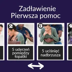 Pierwsza pomoc przy zadławieniu: zachęcaj do kaszlu, wykonaj 5 uderzeń między łopatki, 5 uciśnięć nadbrzusza, a w razie potrzeby RKO.