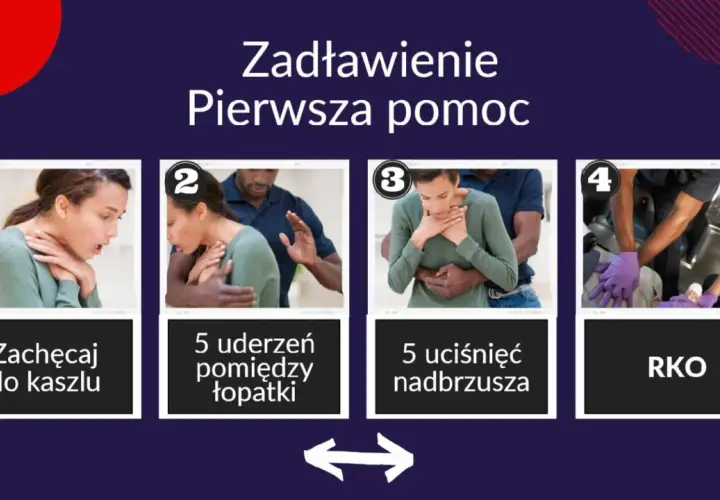 Pierwsza pomoc przy zadławieniu: zachęcaj do kaszlu, wykonaj 5 uderzeń między łopatki, 5 uciśnięć nadbrzusza, a w razie potrzeby RKO.